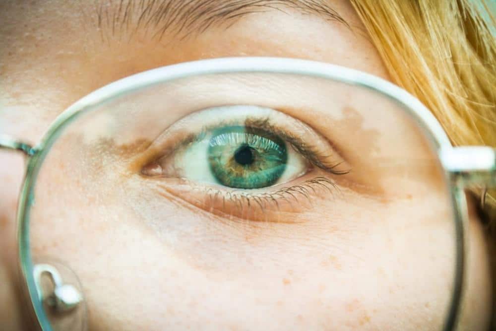 First Steps in Dealing With an Eye Infection | Classic Vision Care