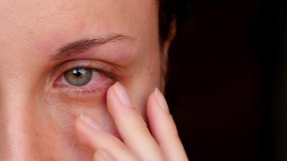 4 Causes of Red, Itchy Eyes - Classic Vision Care