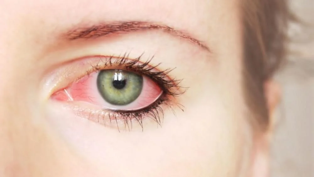 picture of woman's eyes are flared up red